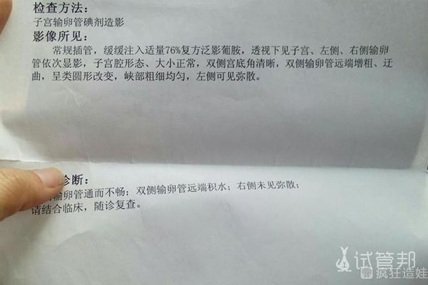 感谢深圳恒生医院，做第二代试管婴儿让我“儿女双全”