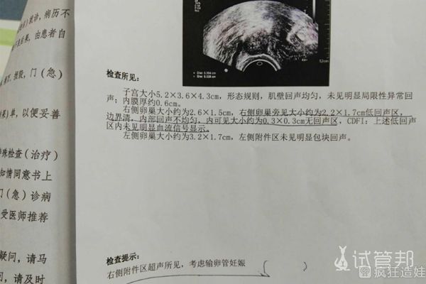 求子5年遭遇宫外孕、第二代试管婴儿着床失败，过来人的经验之谈！