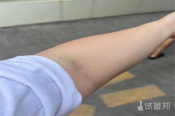 深圳恒生医院试管婴儿成功怀上双胞胎