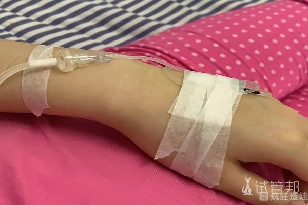 在常德第一人民医院第二代试管婴儿取卵后 要怎么预防腹水