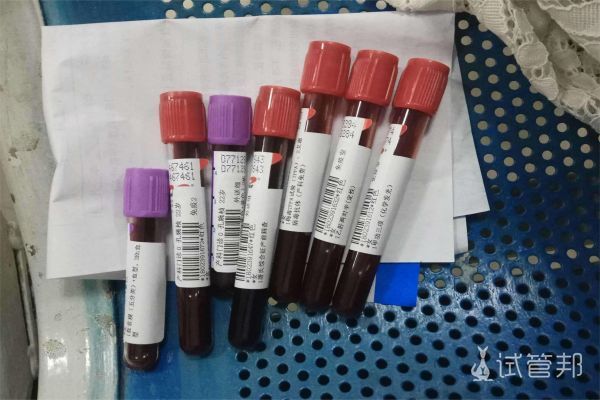 聊城市第二人民医院试管婴儿费用持续更新，记得关注