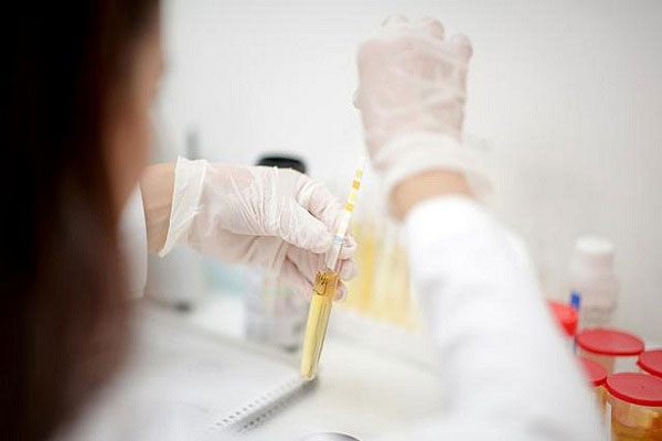尿酸高做试管有没有影响?有这几大影响别不当回事儿