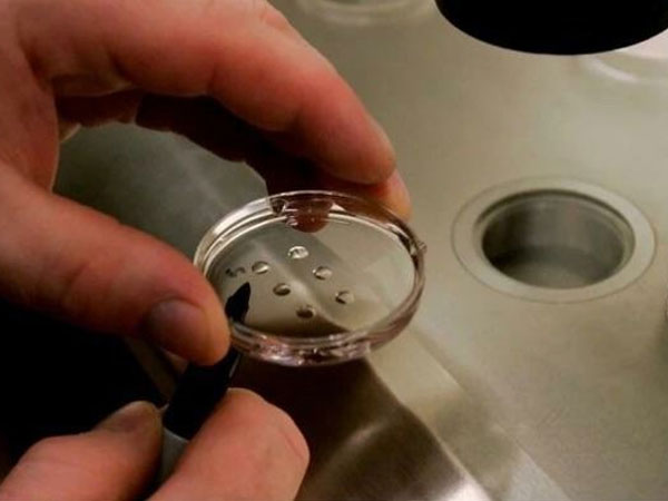 养囊第一天没出结果是正常情况，但失败不通知也不无可能