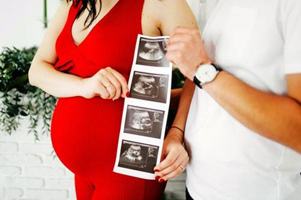 b超图怎么看图解 最明显的女宝b超图