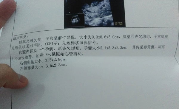 孕早期胎芽长得快慢就能预测胎儿性别?胎芽看男女准确率高么