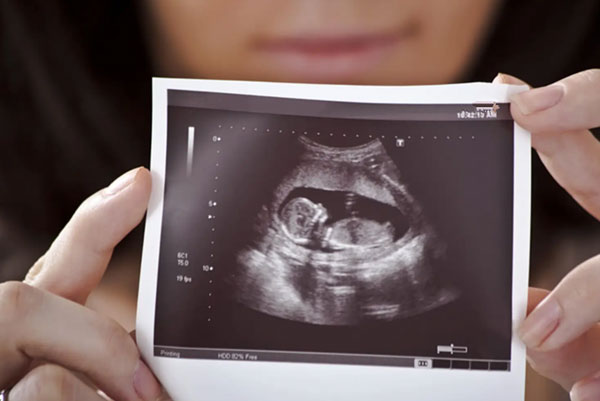 试管怀孕后的一超二超三超时间，千万别弄错了