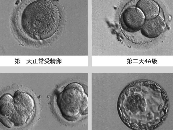 养囊第三天没出结果别着急，5细胞也有希望养成功