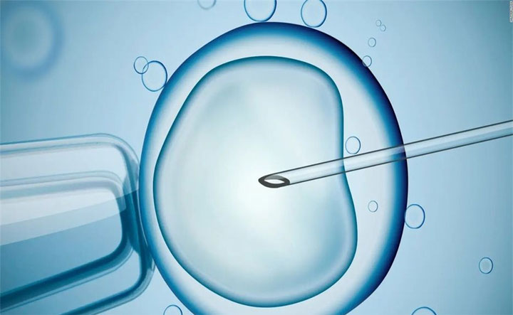 试管哪个方案成功率最高？影响成功率的一般有四个因素