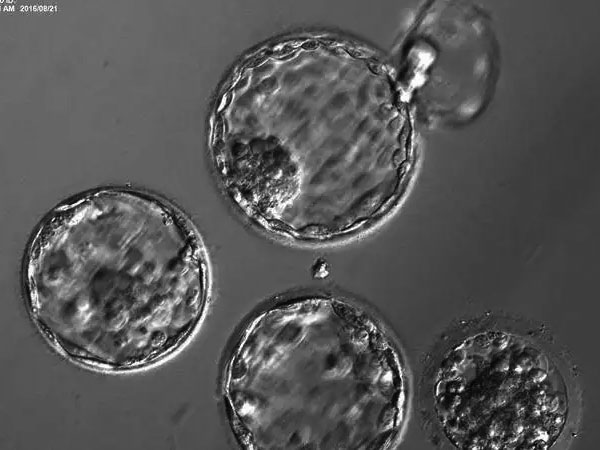 养囊第四天胚胎原来是这个状态，发育慢并不代表没希望