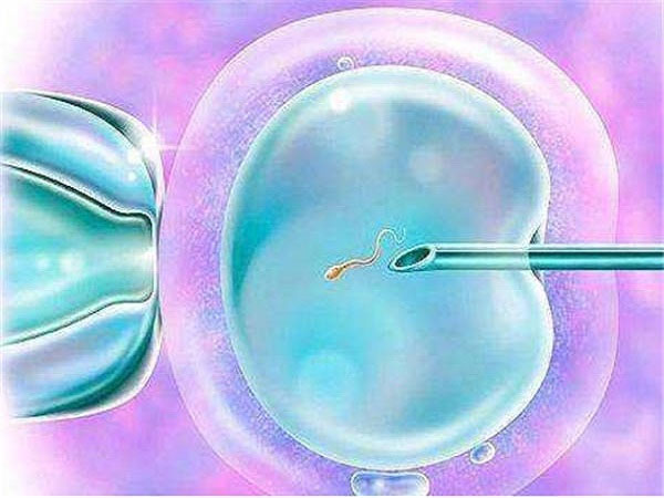 带您轻松了解试管art方案是什么意思