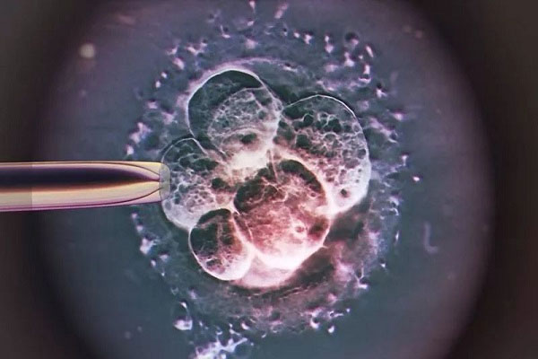 试管取卵后可以吃哪些水果？苹果、红枣等卵巢恢复都是有好处的。