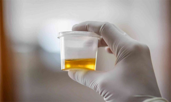 都说hcg翻倍不好迟早胎停，但是在涨也会保不住？