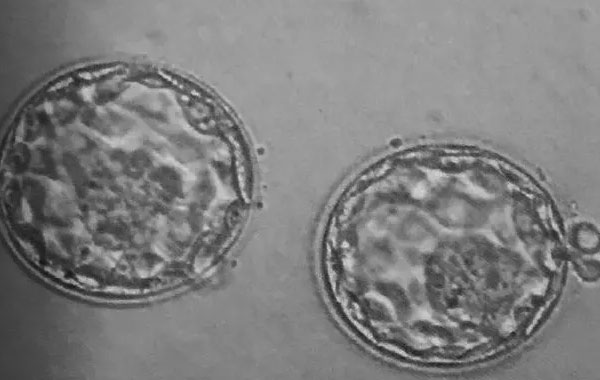 养囊第六天与性别关系真不大，注意移植成功率才是关键