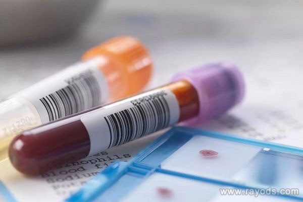o型血孕妇患abo溶血症几率大，做好预防从备孕开始