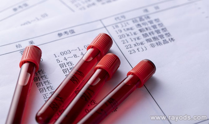 第一次听说睾酮这个医学术语，它是什么意思？