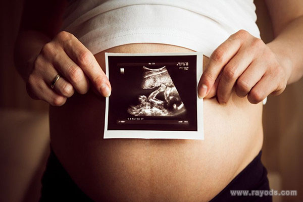 B超三条白线是女孩 NT三个亮点是男孩女孩