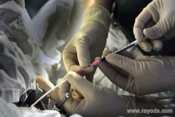 美国试管婴儿专家：从4个方面确保IVF的安全性