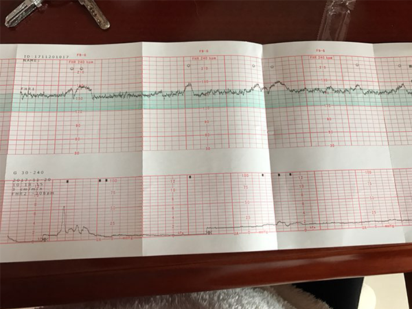 都说做胎心监护其实是个坑，到底有没有必要再做