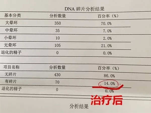 精子DNA碎片率高对生育影响大，掌握改善方法方可“一击即中”