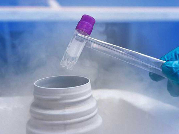 精子库储存精子的费用真不贵,北医三院冷冻一年仅需千元