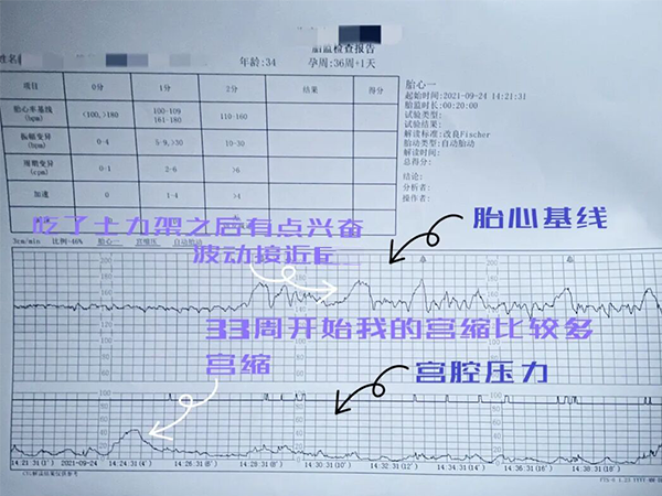 还不知道胎心监护图结果怎么看？产科医生教你搞定它
