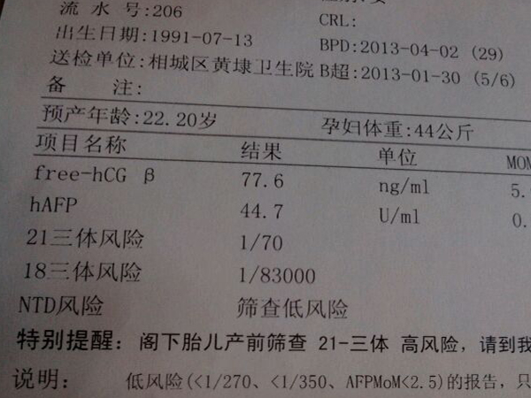 跟性别真没关系，21三体高风险并不全是男孩