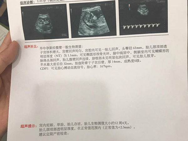 NT三个亮点也能看性别，男孩女孩一秒知