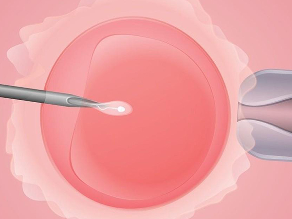 高龄失独家庭也能做试管，没有年龄限制只看这三点