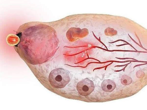 详细解读排卵试纸强阳，即将排出or已经排出本文见分晓