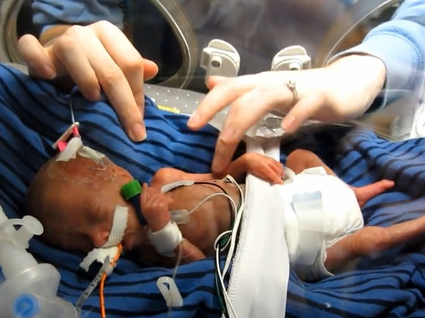 婴儿早产近4个月被医护救下，这些喂养技巧赶紧学起来