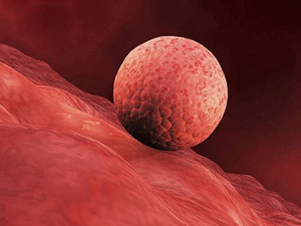 鲜胚移植不是想做就做，这三类女性群体才最适合