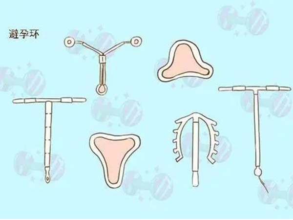 女性上环种类图解：这几种节育环最常用