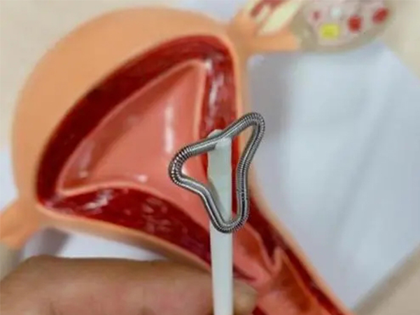 上环前这三点注意事项不能少，月经不干净真做不了