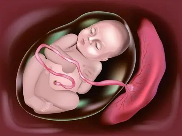 解读形成完全性前置胎盘的三种原因，子宫损伤或成关键