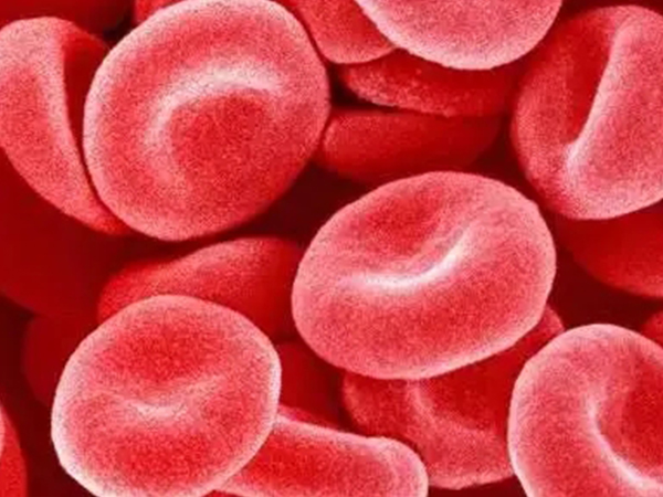 详述血精的四大症状，只知道精液带血丝太过片面