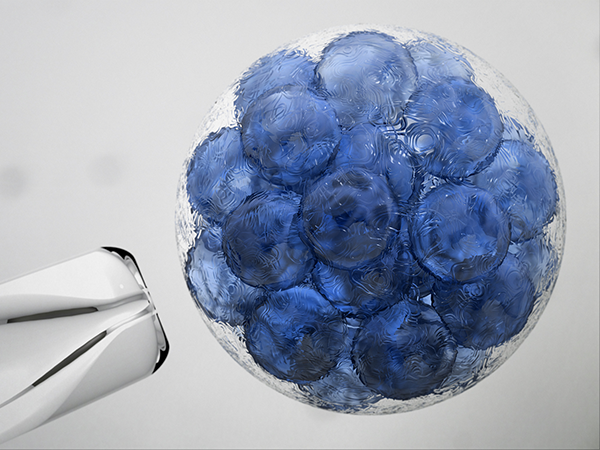 浅析穿刺取卵一次对女性的伤害：卵巢刺激的后遗症真得上心