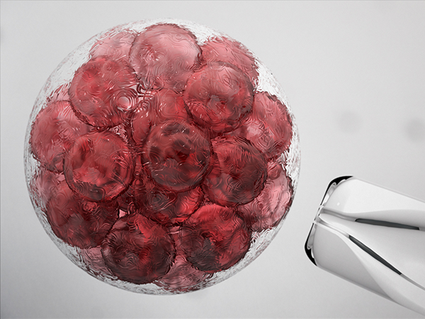 三分钟了解穿刺取卵手术全过程，这穿刺针看着都疼