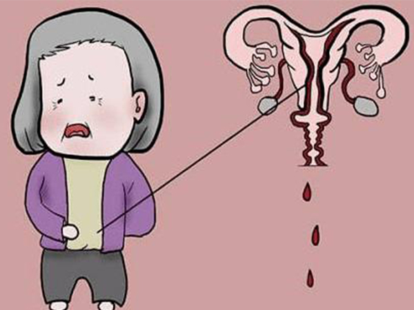 更年期和闭经谁先来？读懂二者区别你就懂了