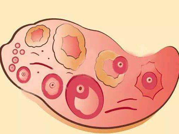 卵泡生长缓慢的女性看过来，用这三招卵泡长得快不是梦