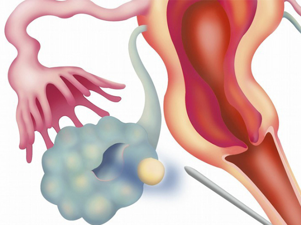 试管婴儿最难的一关并非移植，这一操作才是举步维艰