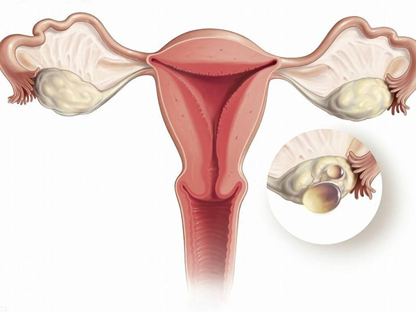 卵泡正常个数标准参考值来了，数量太多可能有患病风险