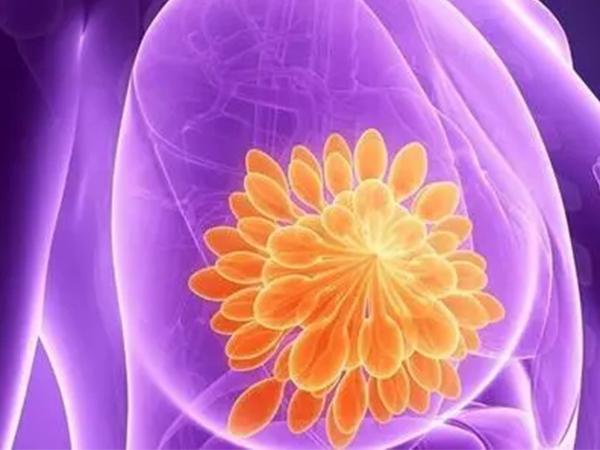 自己判断乳腺增生并不难，这个部位疼大概率是中招了