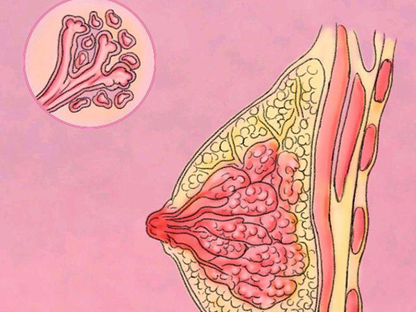 乳腺结节最怕这三种运动，不喜欢通过扩胸缓解还能这样做