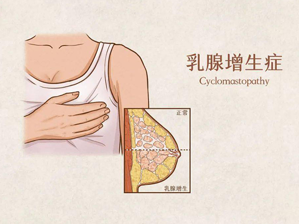 乳腺增生这6种食物不能吃，高脂肪真得当成饮食禁忌对待