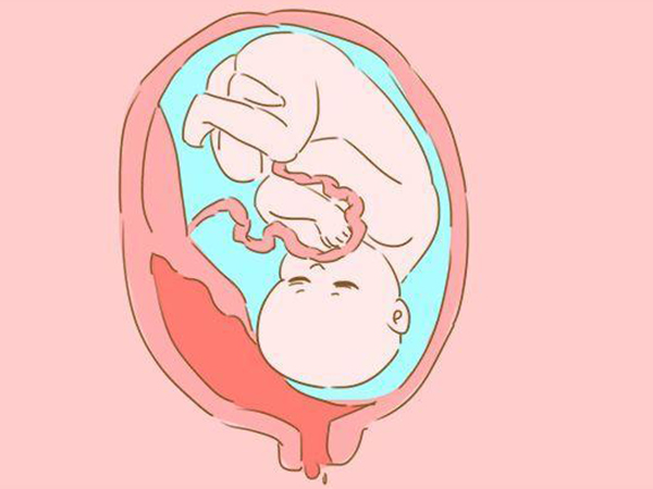孕7月胎位不正往往是这些原因，这次该羊水背锅了
