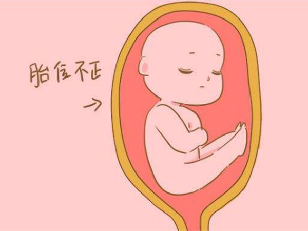 孕30周调整胎位不正不用去医院，学会这个动作在家也能做