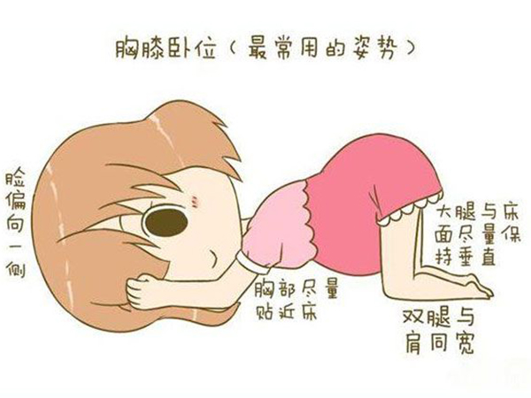 32周纠正胎位不正看这张图就够了，一分钟教会你正确姿势