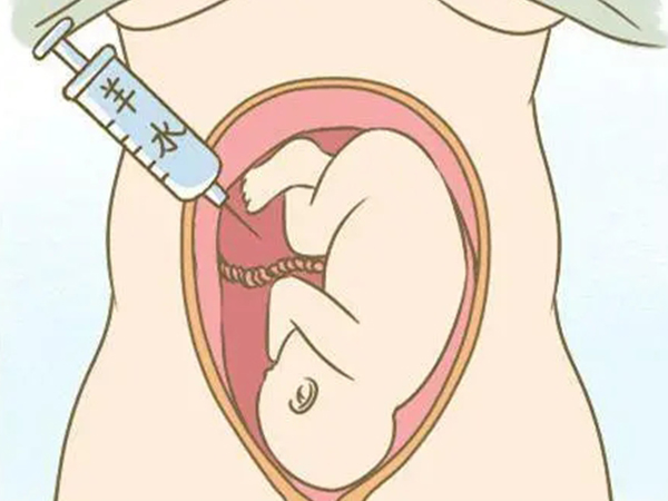 别再说羊水穿刺是必做项目了，这两类孕妇真的不适合