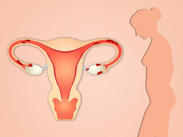 宫颈有问题时常有这五大前兆，远不止表现出外阴瘙痒