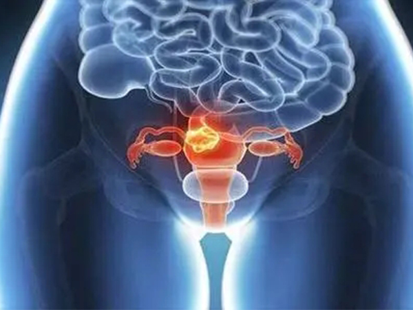 重度子宫下垂时这些症状很明显，比起轻度要严重的多